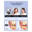 BEBIRD T5 3MP KAMERA 3.5MM LENS ŞARJLI WIFI GÖRÜNTÜLÜ KULAK TEMİZLEYİCİ SİYAH RENK